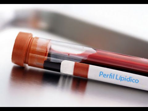 Jejum prolongado poderá ser dispensado em exames de perfil lipídico hqdefault