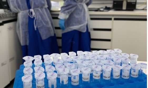 Pesquisadores identificam coinfecção de pacientes por duas linhagens diferentes do vírus causador da Covid-19 feevale 2
