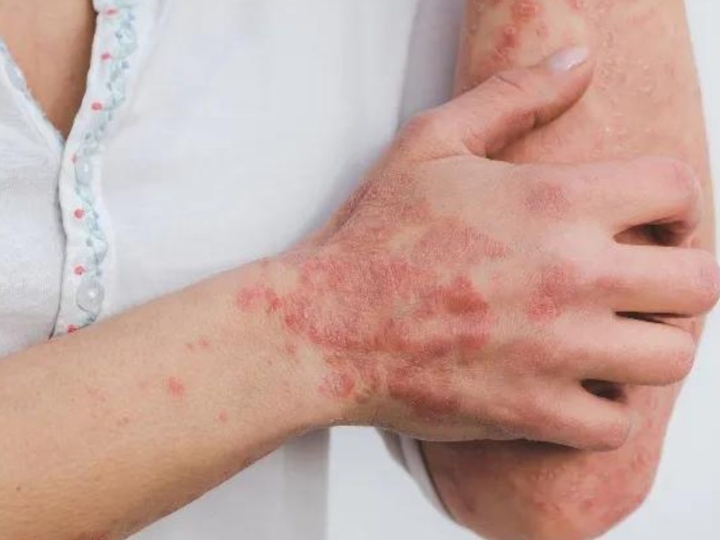 Saúde capacita profissionais para combater a esporotricose WhatsApp Image 2025 03 27 at 15.02.11