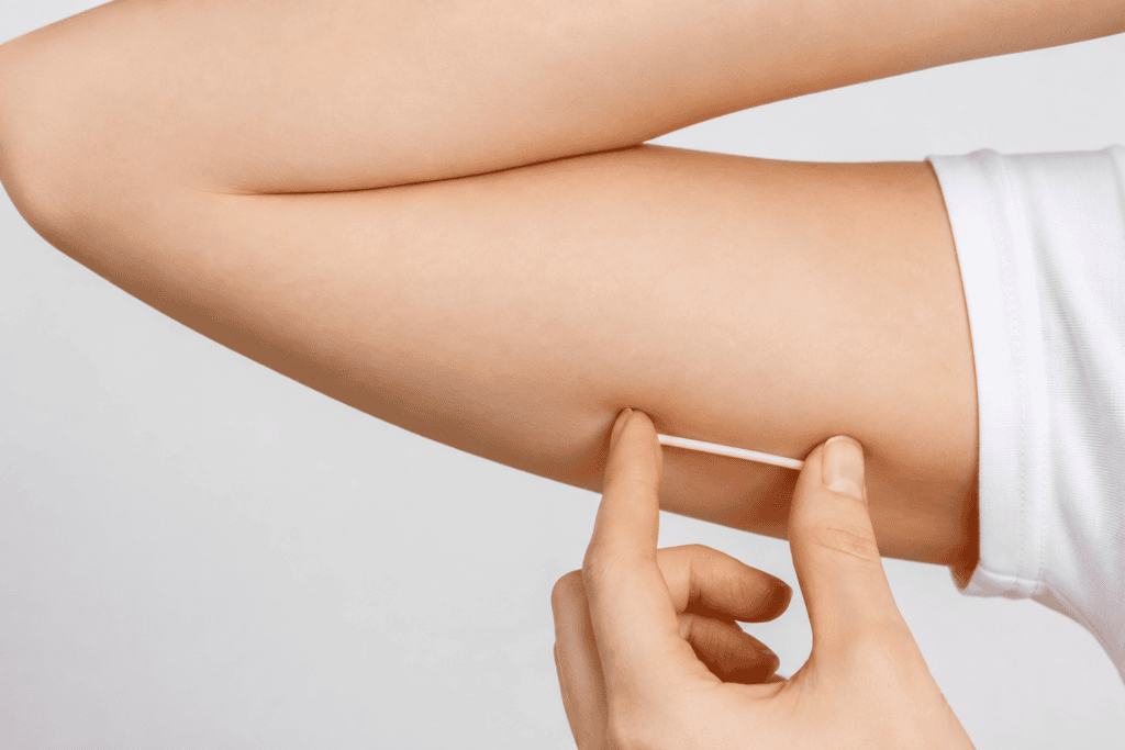Estância Velha amplia acesso ao Implanon pelo SUS Implante contraceptivo Implanon oferecido pelo SUS em Estância Velha