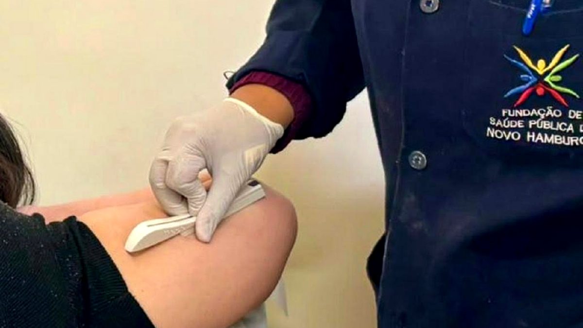 Novo Hamburgo amplia acesso a contraceptivos de longa duração pelo SUS