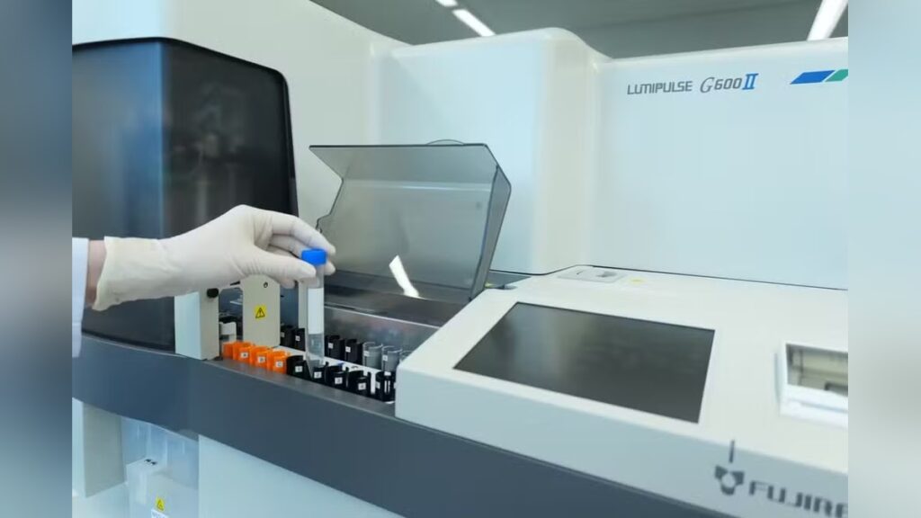 Porto Alegre passa a oferecer exame de sangue que auxilia na investigação do Alzheimer Equipamento Lumipulse para análise de amostras de sangue na investigação do Alzheimer.
